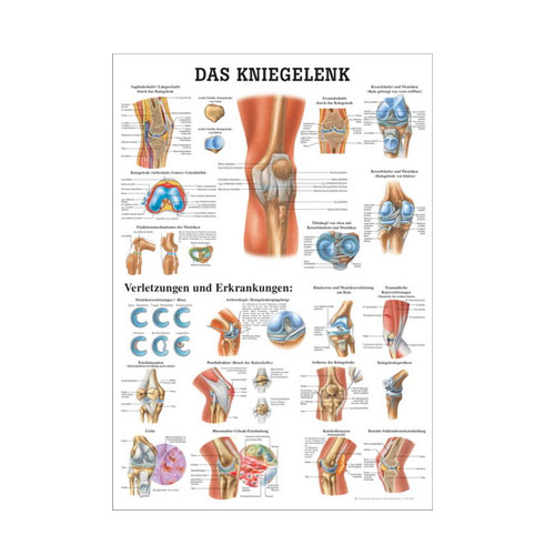 Anatomische Lehrtafel - Das Kniegelenk - Details