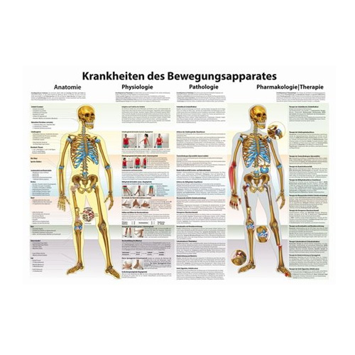 Anatomische Lehrtafel - Krankheiten des Bewegungsapparates - Details